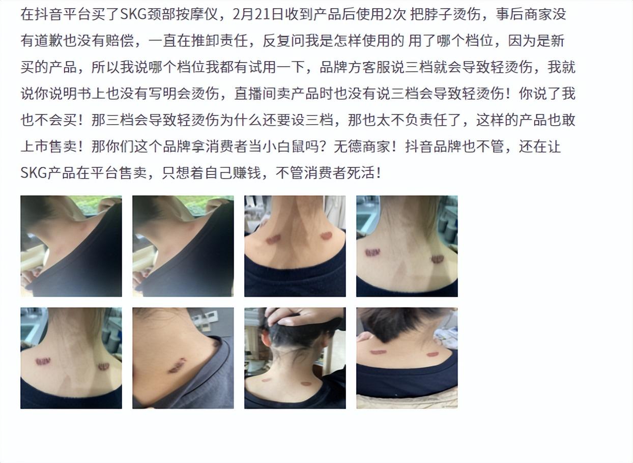 SKG是什么品牌？分享skg品牌介紹及產品質量優勢分析